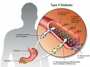 How To Control Diabetes and Diabetes Help